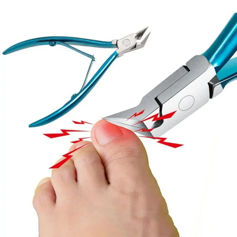 Toenail Clippers For Thick Ingrown 1Pcs Opening Non-Slip - Image 3